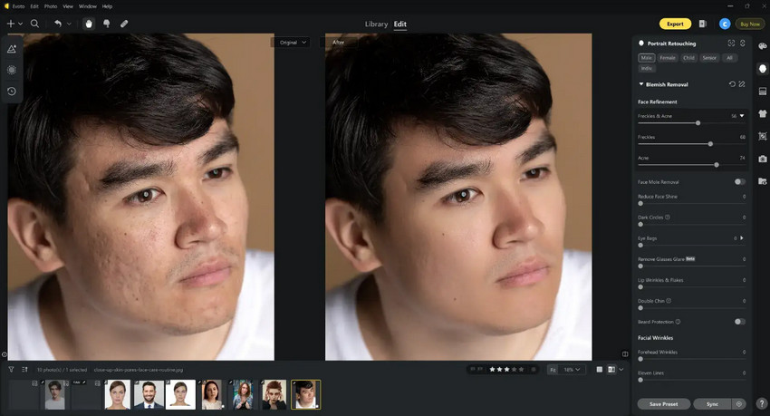 Evoto AI blemish remover