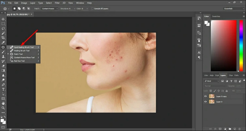 Professional blemish remover - Photoshop