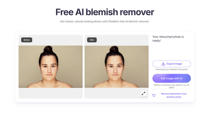 Pixelbin online blemish remover