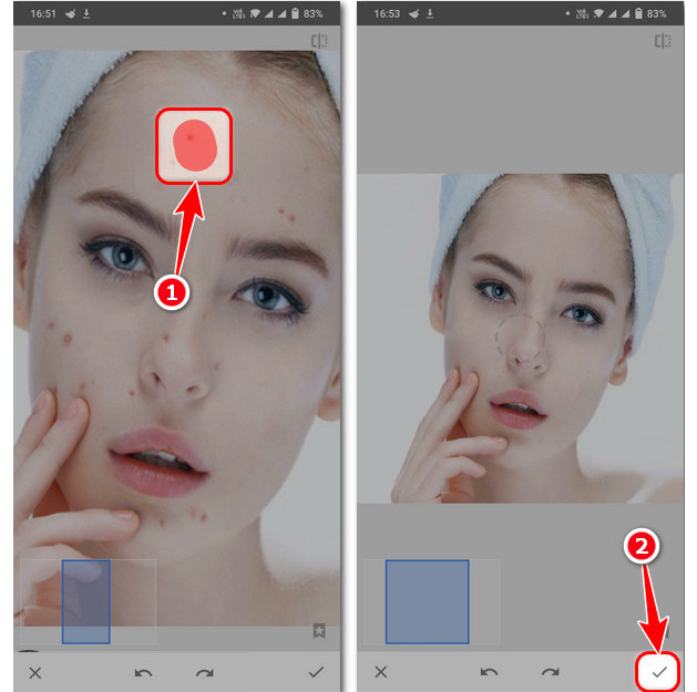 Snapseed healing tool blemish removal