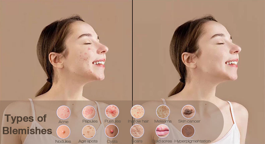 What Are Blemishes in Photos