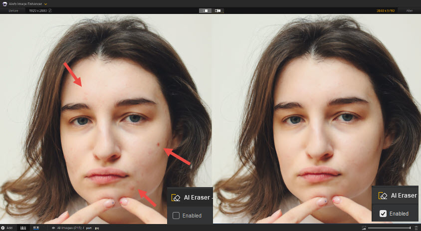 Remove Blemishes Skin Comparison